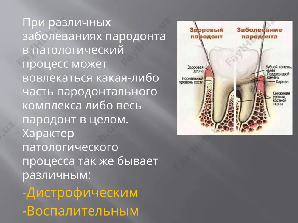 не должен превышать 1; индекс больше 1 является показателем плохого гигиенического состояния полости рта. вид прикуса, наличие первичной или вторичной травматической окклюзии. окклюдограмму составляют на основании отпечатков, полученных на контактных восковых пластинках или специальных подковообразных полосках с прокладкой из фольги, что предотвращает их деформацию и позволяет сохранять их длительное время. восковую пластинку вводят в полость рта и предлагают больному сомкнуть челюсти в состоянии центральной, сагиттальной, трансверсальной (правой и левой) окклюзии. полученные на пластинке отпечатки переносят в зубную формулу с использованием обозначений: ( + ) — наличие контактов, (—) — отсутствие контакта. для расчета индекса полученной при помощи бюгельного воска окклюдограммы пользуются трёхбалльной системой оценки каждой пары антагонистов. индекс окклюдограммы определяется с учетом 14 пар зубов-антагонистов: 7-4 3-1 1-3 4-7 7-4 3-1 1-3 4-7 1 балл — на окклюдограмме отсутствуют отпечатки. 2 балла — нечеткие отпечатки. 3 балла — четкие или сквозные отпечатки. индекс окклюдограммы рассчитывается по формуле: индекс окг (%) …