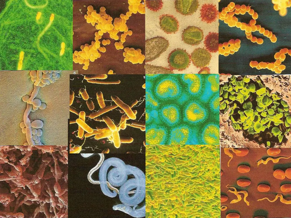 when a person with active tb coughs or sneezes, droplets loaded with the infectious organism are propelled into the air. the moisture evaporates from these particles to leave droplet nuclei that can remain airborne for days and spread long distances. the mycobacterium has a waxy coat, which protects it from drying out allowing it to survive for many months in the air and dust. * fecal-oral mechanism of transmission of infection source infections feces urine sputum (for some infections) food products water hands objects domestic use flies soil food water stage of selection of invader stage of stay of invader in an environment stage of penetration of invader ways of selection factors of transmission ways of transmission contact- domestic receptive organism mode of transmission direct contact – person to person example: gastroenteritis vertical – touching (faecal-oral route) norwalk virus causes a type of gastroenteritis. norwalk virus is found in the …
