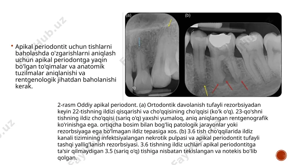 zamonaviy rentgen tashxislash usullari - Page 4