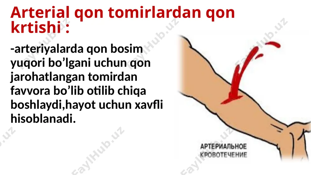 qon ketish turlari va tomirlardan qon ketish turlari - Page 5