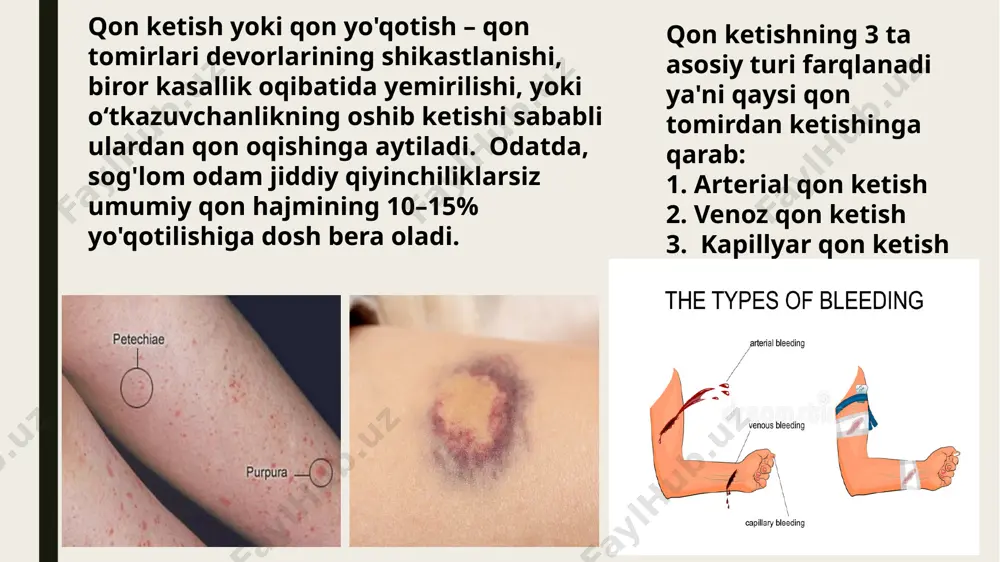 ial xususiyatlari, shuningdek, jelplastanning toksikligi o'rganildi. jelplastan qon koagulyatsiyasini faol ravishda oshiradi, kuchli yopishtiruvchi va uzoq muddatli antibakterial xususiyatlarga ega, to'qimalarda yaxshi so'riladi va tanaga hech qanday nojo'ya ta'sir ko'rsatmaydi. preparat parenximal organlarning shikastlanishi, shuningdek, yaralar va tayanch-harakat a'zolarining ochiq jarohatlarida intensiv diffuz qon ketishini to'xtatish uchun mahalliy gemostatik vosita sifatida qo'llanilishini topdi. jelplastan 2,5 g va 5 g flakonlarda kukun shaklida mavjud. farmakologik xossalari: preparatning gemostatik ta'siri uning tarkibidagi antigemorragik vitamin k (fillakinon) ning ko'pligi bilan bog'liq. bu element tanadagi qon aylanishini yaxshilashga yordam beradi, uning normal ivishini saqlaydi. gemostopning ta'sir qilish mexanizmi, bilvosita koagulyantlar bo'lgani uchun, ularning jigarda protrombin va prokonvertin sintezida, ii, vii, ix, x plazma omillarining sintezida, gemostazning koagulyatsion aloqasini faollashtirishda ishtirok etishi bilan bog'liq. qon ivish omillarini sintez qilishda ishtirok etishdan tashqari, gemostop jigarda albuminlar, mioalbuminlar, qon tomirlarining butunligini saqlaydigan omillar sintezi uchun zarurdir. mahalliy foydalanish uchun gemostatik preparat. taxokomb tarkibida kollagen gubkaning yuzasida quruq …