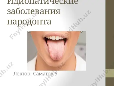 идиопатические заболевания пародонта — PPTX
