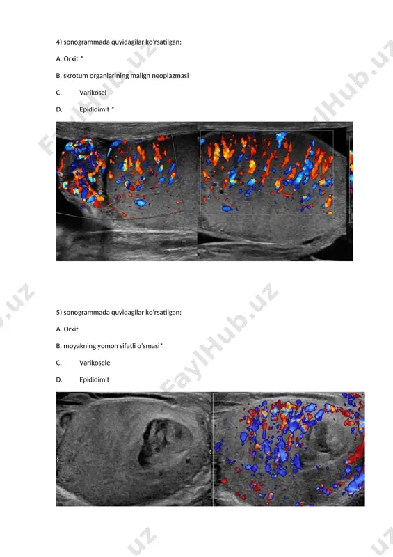 prostata adenomasi - Page 3