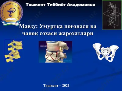 umurtqa po‘gonasi va chanok sohasi jarohatlari — PPT