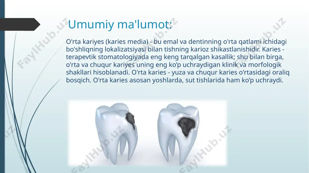 g'ri dentinga o'tadi. shu bilan birga, mikrob massalari kengaygan dentin naychalariga kirib boradi, ularning toksinlari ta'sirida odontoblastlar faoliyati distrofik va nekrotik o'zgarishlarga uchraydi. mikroorganizmlarning qoldiqlari dentin kanalchalariga chuqur kirib, dentin demineralizatsiyasi va yumshatish jarayonlarini keltirib chiqaradi. alomatlar: o'rta kariyesning klinik belgilari yengildir. tishning kimyoviy va harorat ta'siriga reaktsiyasi kuchayadi, o'rtacha yoki zaif intensivlikdagi qisqa muddatli og'riqlar paydo bo’ladi. odatda, barcha noxush tuyg'ular sababchi omil bartaraf etilgandan so'ng tez orada yo'qoladi. ba'zida shikoyatlar umuman yo'q bo'lishi mumkin. o'rta kariyesli tish sohasida bemorlar oziq-ovqat qoldiqlari to'plangan qora nuqta yoki bo'shliq paydo bo'lishini sezishlari mumkin. oxirgi holat yomon hidga olib kelishi mumkin. o’rta kariesning oldini olish uchun quyidagilarga amal qilish lozim: • profilaktik tekshiruvlar uchun har 6 oyda bir marta tish shifokoriga muntazam tashrif buyurish; • mavjud karioz o'choqlarni o'z vaqtida davolashni amalga oshirish; • to'g'ri tish cho'tkasi, pasta va ipni tanlash; • kuniga ikki marta tishlarni yaxshilab yuvish, ovqatdan keyin buni qilishning …