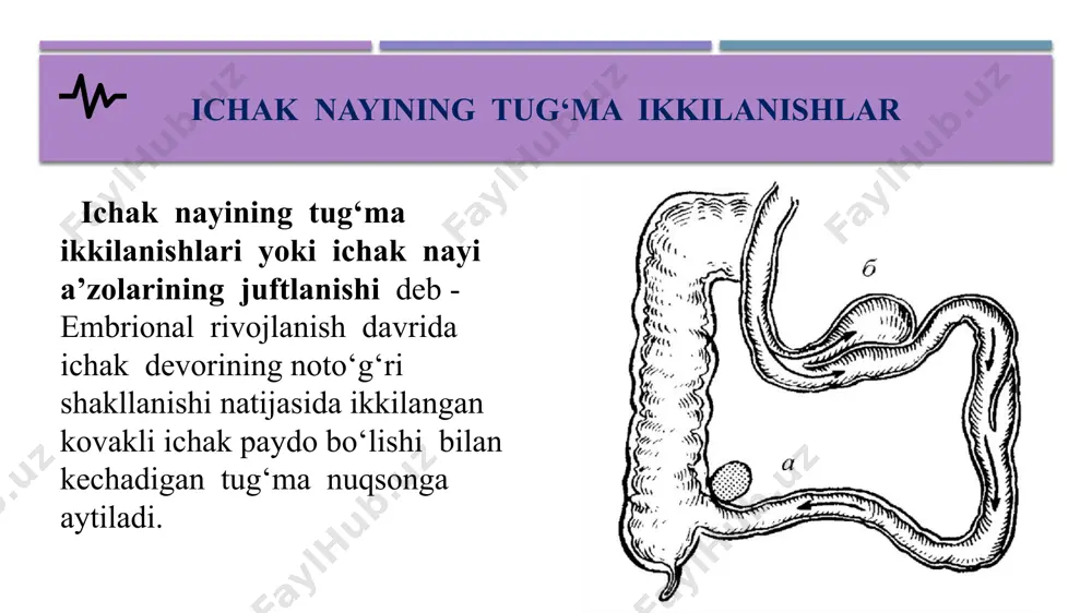 muolajasi davomida kutilmaganda topiladi. lekin ba’zan (asosan, shilliq qavat distopiyasida) dublikaturalar behosdan ichak­dan kuchli qon ketishi bilan namoyon bo‘lishi mumkin. ikkilanish­ning kistoz turi (enterokistalar) goho juda kattalashib, qisman ichak tutilishi va ichak bo‘shlig‘ining to‘liq yopilishi yoki tashqaridan siqilishiga olib keladi. ba’zan kista atrofida ichaklar buralib qoladi va o‘tkir strangulyatsion ichak tutilishining klinik manzarasi rivojlanadi. homiladorlik paytida enterokista atrofida ichaklar buralib qolishi ichaklaming ikkilamchi atreziyasiga olib kelishi mumkin. enterokistoma ichak qovuzlog’i rezeksiyadan keying enterokistoma ko‘krak qafasiga kiruvchi divertikullarda - disfagiya va atelektaz, bronxoektaz va nafas olishning boshqa buzilishlari kuzatiladi. yo‘g‘on ichakning ikkilanishi - surunkali qabziyat bilan na­moyon bo‘ladi. rektal tekshiruv paytida bemorlarda og‘riqsiz, yumshoq elastik konsistensiyali o‘smasimon hosila paypaslanadi. to‘g‘ri ichakning ikkilanishida - odatda siydik sistemasiga qo‘shilgan oqma bo‘ladi. duplikaturalarning asoratlari ichakdan qon ketishidan tashqari, ichak invaginatsiyasi ham ma’lum bo‘lib, bunday hollarda uni konservativ davolash foydasizdir. diagnostikasi. ovqat hazm qilish kovak organlari ikkilanishning diagnostikasi ko‘p hollarda juda katta qiyinchiliklarga ega. til …