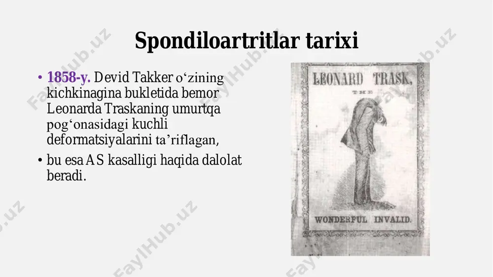 dilitning belgilari bel va orqa qismdagi surunkali og‘riq • og‘riq dam olish vaqtida kuchayadi, harakatlanganda esa kamayadi. • ertalabki soatlarda yoki uzoq o‘tirgandan keyin og‘riq kuchayadi. umurtqa pog‘onasining qattiqlashishi • ertalabki qattiqlik (30 daqiqadan uzoq davom etishi mumkin). • kasallik rivojlanib borgani sari umurtqa pog‘onasining harakatchanligi kamayadi. sakroiliit – dumg‘aza-bo‘ksa bo‘g‘imlarining yallig‘lanishi • dumg‘aza sohasida og‘riq va noqulaylik hissi. bo‘g‘im va tendonlar shikastlanishi • tizza, to‘piq va yelka bo‘g‘imlarida yallig‘lanish. i entesit – paylarning suyakga birikadigan joyida og‘riq va shish. ekstraskelet belgilar (bo‘g‘imlardan tashqari a’zolar zararlanishi) • ko‘z kasalliklari – uveit (ko‘zning yallig‘lanishi), qizarish va ko‘rish buzilishi. • o‘pka va yurak muammolari – kech bosqichda rivojlanishi mumkin. • ichak va buyrak kasalliklari – ayrim bemorlarda kuzatiladi. nega ankilozlovchi spondilit (bekhterev kasalligi) tashxisi kech qo‘yiladi? • o‘rtacha, bemorlarga to‘g‘ri tashxis qo‘yish 8-10 yilga kechikishi mumkin. buning bir necha asosiy sabablari bor: 1. kasallikning asta-sekin rivojlanishi • asning dastlabki bosqichida bel va …