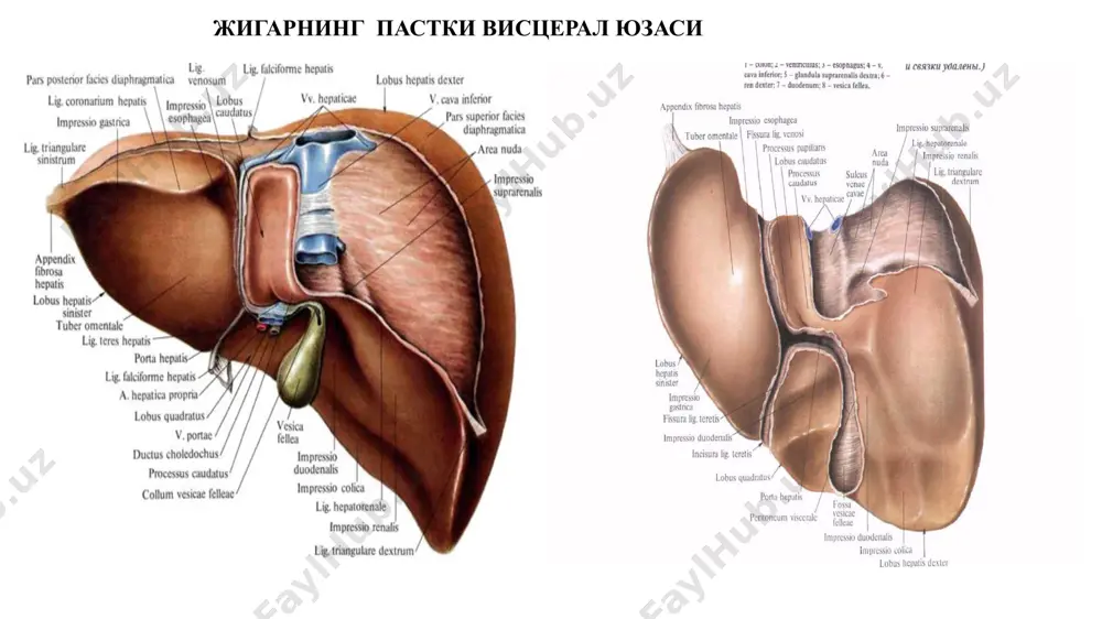 ангиокарцинома. 3.ўт йўллари цистаденокарциномаси. 4.аралаш гепатохолангиоцеллюляр рак. 5.гепатобластома. 6.такомиллашмаган рак. ii.ноэпителиал ўсмалар. а.гемангиома. б. инфантил гемангиоэндотелиома. в.гемангиосаркома. г. эмбрионал саркома. д. бошқалар. iii. турли бошқа типдаги ўсмалар. а.тератома. б. карциносаркома. в.бошқалар жигар ўсмаларнинг гистологик классификацияси (бжсст, 1983) iv.таснифланмайдиган ўсмалар. v.қон ишлаб чиқарувчи ва лимфоид тўқима ўсмалари. vi.метастатик ўсмалар. vii.эпителий аномалиялари. а. гепатоцитлар дисплазияси. б. ўт йўллари аномалияси. viii.ўсмасимон жараёнлар. а.гамартомалар. 1. мезенхимал гамартома. 2. билиар гамартома (микрогамартома, комплекс ван мейенбурга). б. туғма билиар кисталар. в.ўчоқли тугунли гиперплазия. г. компенсатор бўлакли гиперплазия. д. пурпурли жигар. е. гетеротопия. ж. бошқалар. бирламчи гепатоцеллюлляр жигар кўпроқ (70-80%) ҳолларда учраса, холангиокарцинома камроқ (20—30 %) ҳолларда учрайди. гцр кўпинча жигар циррози билан бирга келади, холангикарцинома жигар циррози билан кам ҳолларда ( 25 %) биргаликда қўшилиб келади. жигар бирламчи ракининг макроскопик шакллари i.тугунли шакли — энг кўп учраб барча шаклдаги жигар ракининг 60—85 %ини ташкил этади.деярли ҳамиша жигар циррози билан қўшилиб келади.катталашган жигар паренхимасида кўплаб ўсма ўчоқлари …