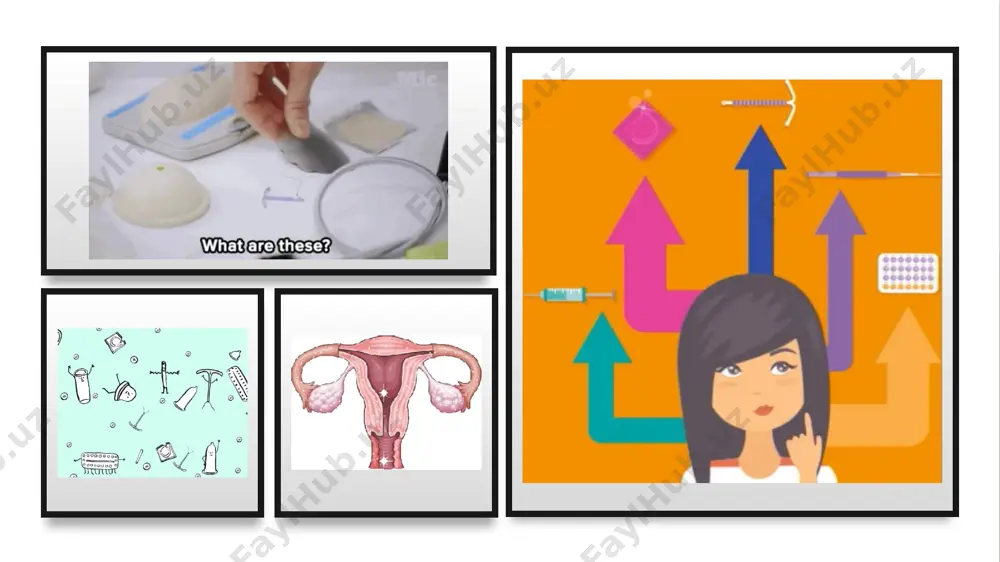 vskix stranax, rossii. medsoderjashie vnutrimatochnie kontratseptivi (vmk) nedostatki: boli vnizu jivota obilnie menstruatsii, privodyashie k jelezodefitsitnoy anenmii visokiy risk razvitiya vospalitelnix zabolevaniy organov malogo taza neobxodimost proverki vmk posle kajdoy menstruatsii ogranicheniya po primeneniyu u molodix nerojavshix jenshin jenshini priznali naibolee znachimim izobreteniem xx veka…. gormonalnuyu tabletku! gormonalnaya kontratseptsiya klassifikatsiya gormonalnix kontratseptivov oralnie: monofaznie mnogofaznie (dvufaznie, trexfaznie) parenteralnie: in'ektsii vlagalishnoe koltso plastiri chisto progestagennie kontratseptivi oralnie: «mini-pili» parenteralnie: implanti in'ektsii vlagalishnie koltsa s progestagenom vnutrimatochnaya gormonalnaya sistema (mirena) dlya lecheniya (dopolnitelnie nekontratseptivnie preimushestva – mogut bit propisani v instruktsii k preparatu i prisutstvuyut v klinicheskix rekomendatsiyax po otdelnim nozologiyam) dlya kontratseptsii (osnovnoe pokazanie) ispolzovanie kok oralnie kontratseptivi chto takoe kombinirovanniy oralniy kontratseptiv? estrogen gestagen kombinirovanniy oralniy kontratseptiv potentsirovanie kontratseptivnogo effekta gestagena i normalizatsiya menstrualnogo tsikla kontratseptivniy effekt tabletki nujno prinimat ejednevno, jelatelno v odno i to je vremya v techenie 21 ili 28 dney (v zavisimosti ot preparata). 24 vozmojnosti …