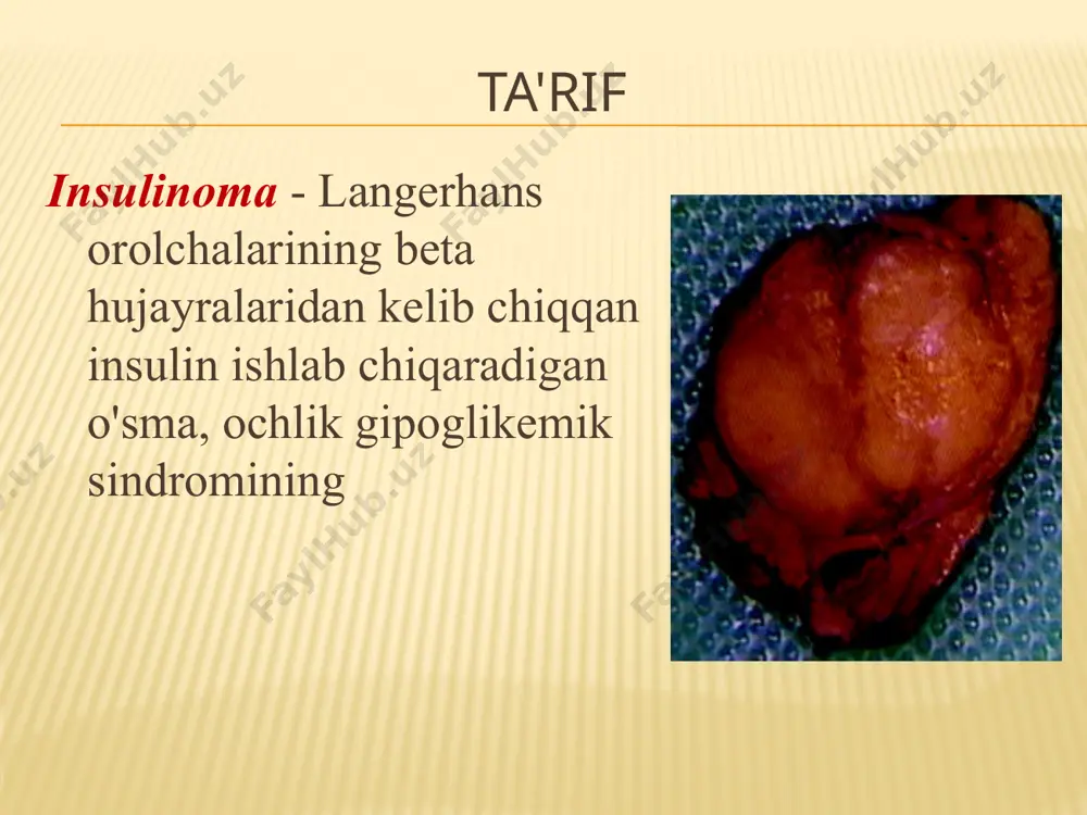 ari 13,0-12,4 mm o'lchamdagi massa - insulinoma aniqlanadi . x-nurli kompyuter tomografiyasi oshqozon osti bezining dumi sohasida ultratovush ma'lumotlariga mos keladigan hajmli shakllanish (strelka) aniqlanadi. oktreoksan konservativ davo. prinsiplar gipoglikemik sharoitlarni bartaraf etish va oldini olish. o'simta jarayoniga ta'siri. bemorni tez-tez ovqatlantirish. dori terapiyasi 1) giperglisemik vositalar: - adrenalin ( epinefrin ); - norepinefrin; - glyukagon. 2) glyukokortikoidlar : - difenilgidantoin ( difenin ); - diazoksid ( giperstat , proglikemiya ). kimyoterapiya streptozotsin iv infuzion , sutkalik doza - 2 g gacha, kurs dozasi - 30 g gacha. doksorubitsin ( adriamitsin , adriablastin , rastotsin ). image3.jpeg image4.jpeg image5.jpeg image6.jpeg image7.jpeg image8.jpeg image9.jpeg image10.png image11.jpeg image12.jpeg image13.jpeg image14.jpeg image15.jpeg image16.jpeg image17.jpeg image18.jpeg image19.jpeg image20.jpeg image21.jpeg image22.jpeg image23.png image24.jpeg image25.jpeg image26.jpeg image27.jpeg image28.jpeg image29.jpeg /docprops/thumbnail.jpeg