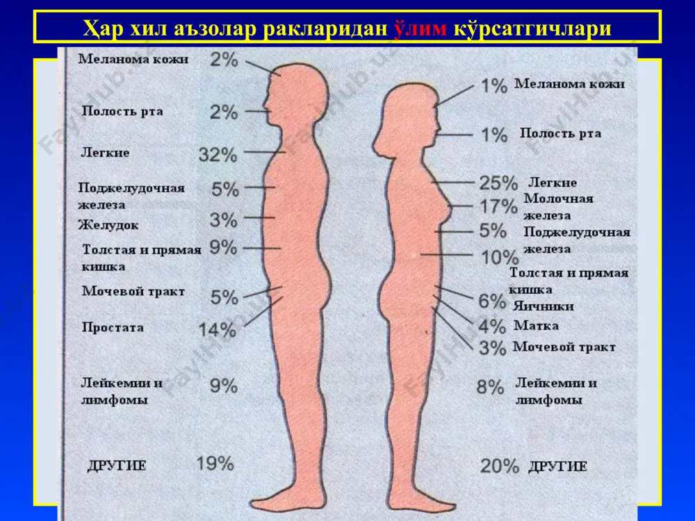 ва х. хавфли ўсмалари - тўқима ёки ҳужайранинг лотинча номига +саркома қўшиб номланади: остесаркома, хондросаркома, липосакрома, лейомиосакрома, рабдомиосаркома ва х. мезенхимал тўқима ўсмалари мезенхимал тўқима ўсмалари тўқима хавфсиз хавфли 1) бириктирувчи тўқима (фиброз тўқима) фиброма: қаттиқ, юмшоқ, десмоид фибросаркома: дифференциалланган, дифференциалланмаган 2) ёғ тўқима (қўнғир ёғ) липома (гибернома) липосаркома 3) силлиқ мушак лейомиома лейомиосаркома 4) кўндаланг тарғил мушак рабдомиома рабдомиосаркома 5) қон томирлар гемангиома: капилляр, веноз, каверноз, гломусангиома ангиосаркома: саркома гемангиоэедотелиал ва гемангиоперицитар 6) лимфа томирлар лимфангиома лимфангиосаркома 7) синовиал парда синовиома синовиал саркома 8) мезотелий мезотелиома мезотелий саркома 9) суяк тўқима остеома остеосаркома 10) тоғай тўқима хондрома хондросаркома фиброма (тери дермасида) фибросаркома мезенхимал тўқима ўсмалари хондрома хондросаркома мезенхимал тўқима ўсмалари жигар каверноз гемангиомаси лимфангиома мезенхимал тўқима ўсмалари