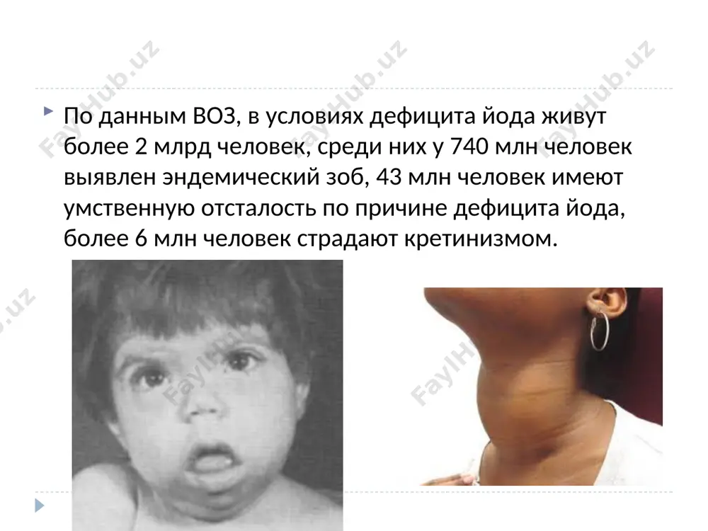 тся умственная отсталость, до 15% школьников испытывают трудности в обучении. при снижении тиреоидных гормонов в йододефицитных регионах в головном мозге уменьшается содержание одного из важнейших нейромедиаторов – нейрогранина, следствием чего являются задержка интеллектуального развития, неврологические и глазодвигательные нарушения, снижение памяти, концептуального и числового мышления, затруднения в освоении языка. заболеваемость детей при наличии диффузного эндемического эутиреоидного увеличения щж значительно возрастает. так, инфекционные, сердечно–сосудистые заболевания, гастрит, дуоденит, дискинезии желчных путей, аллергический ринит отмечаются в 2 раза чаще, тонзилит, кариес – в 1,5 раза, нарушения формирования скелета – в 3 раза, а искривления позвоночника – в 4 раза чаще, чем у детей без увеличения щж. профилактика и лечение йододефицита массовая профилактика: йодирование соли и продуктов питания. в некоторых странах йод добавляют уже в корм сельскохозяйственных животных. групповая профилактика: особая забота об отдельных группах населения. к ним относятся дети, подростки, беременные и кормящие женщины. индивидуальная профилактика: осуществляет любой человек, осознающий необходимость достаточного потребления йода. …
