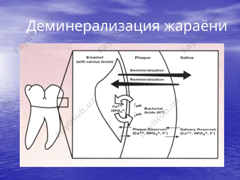 кариес ҳақида тушунча. кариес ковакларни таснифи - Page 4