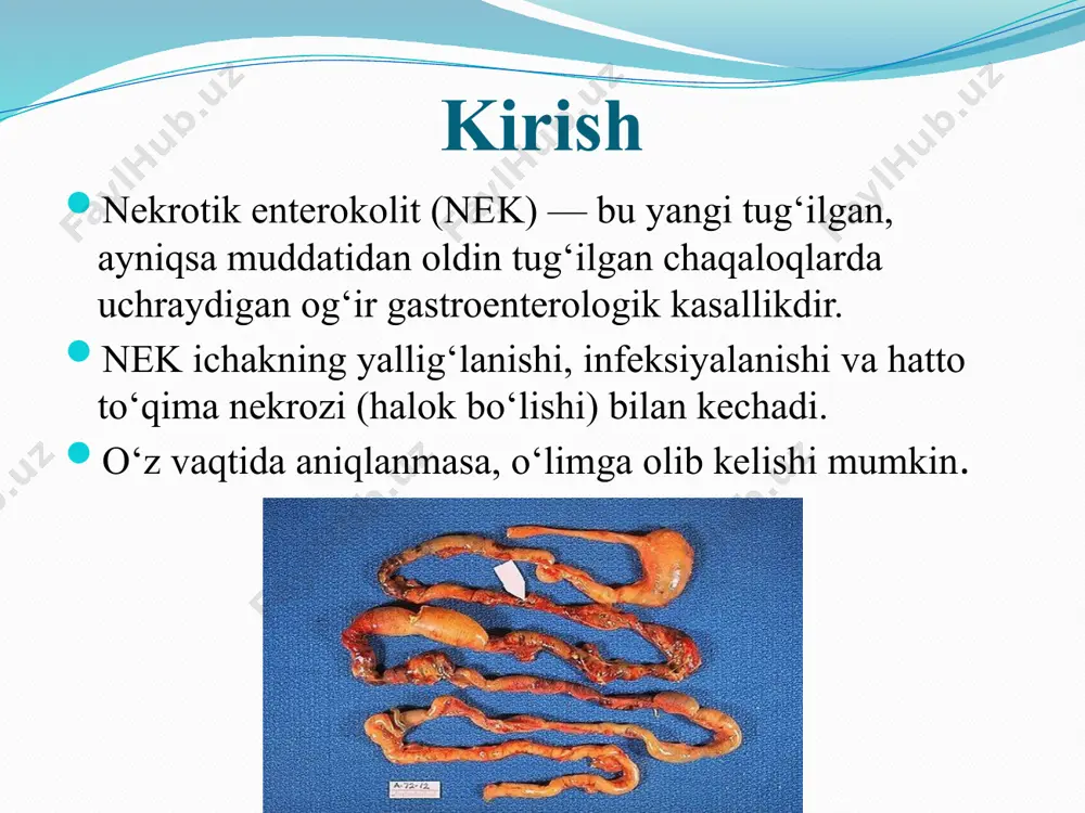 bilan oziqlantirish • oziqlantirishni bosqichma-bosqich boshlash • probiotiklardan foydalanish • neonatal reanimatsiyada sanitariya qoidalariga rioya qilish • homiladorlik paytida onani yaxshi nazorat qilish xulosa • nek bu og‘ir va xavfli kasallik bo‘lib, muddatidan oldin tug‘ilgan chaqaloqlarda tez-tez uchraydi. • vaqtida aniqlash va to‘g‘ri davolash o‘lim xavfini kamaytiradi. • oldini olish choralari nec rivojlanishini sezilarli darajada kamaytiradi. • neonatologiyaning dolzarb va dolzarbligicha qolayotgan muammolaridan biri hisoblanadi. image2.png image3.png image4.png /docprops/thumbnail.jpeg