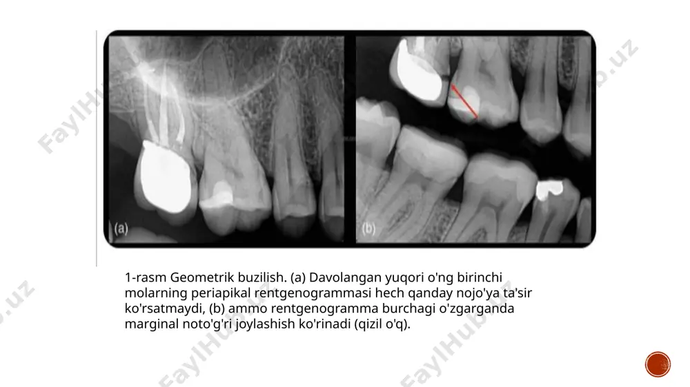 zamonaviy rentgen tashxislash usullari - Page 3