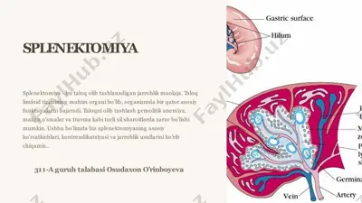 splenektomiya — PPTX