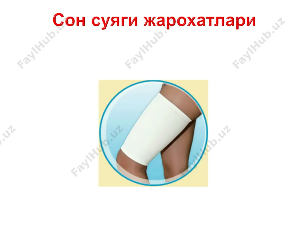 бироз утказиб юборилган сон суяги сохасидаги чикишларни наркоз остида мажбурий, куч остида, имкон кадар охисталик билан тугрилаш амалга оширилади. огир холатларда очик жаррохлик утказишга тугри келади. жуда утказиб юборилган чикишларда хам жаррохлик, артропластика йули билан даволаш кулланилади. -фиксация турлари: -аддукцион (сон суяги якинлашган, буйинча-диафизар бурчаги кичрайган, coxa vara куринишидаги деформация шаклланади, тез-тез учраб туради.) -абдукцион (сон суяги узоклашган, буйинча-диафизар бурчаги катталашган, бу деформация соха valga деб аталади) бемор домий скелет тортмада булади. спица сон суяги думбокчалари устидан утказилади. беморни ортопедик кроватга оркаси билан ёткизилади. болдир суяги остига ортопедик ёстикча куйилади. оёклар ораси бироз узоклаштирилади. скелет тортмага 5-6 кг огирликдаги юк осилади. болдир суяги 2 кг гача огирликдаги юк билан тортиб куйилиб, товонга халка утказилиб, 1 кг юк осиб куйилади. дастлабки 3 кун мобайнида скелет тортмадаги юк 1-2 кг га оширилади. ташки ротацияни бартараф этиш учун сон суяги ва болдир суягига ротацион халкалар куйилади. мехнатга яроклилик 3-4 ойдан кейин тикланади. -булакларни …
