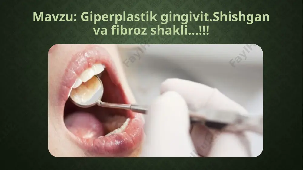 alishi va mustahkamlanishi; gingival papila rangi o'zgarmaydi (pushti pushti turadi); to'qimalarning o'zgarishi ham tashqi tomondan, ham tishlarning ichki qismidan sodir bo'lishi mumkin; noto'g'ri dentogingual cho'ntaklar hosil bo'lishi kuzatiladi; qon ketish kuzatilmaydi. 2. shikast: gingival papilloda o'sish va ularning shishishi; gingival to'qimalar moyli-siyanotik soyani, porloq shishadi, bo'shashib qoladi; noto'g'ri dentogingual cho'ntaklar hosil bo'lishi kuzatiladi; tish go'shtiga qo'l qo'yganingizda qon ketadi; tishlarni tishlamoq, ovqat eyish. gipertrofik gingivitning differentsial diagnostikasi gipertrofik gingivitning tashxisi qo'yilganda, mutaxassis shu kabi simptomlar bilan boshqa patologiyalarni chiqarishi kerak: fibromatoz, epulis, periodontit . surunkali gipertrofik gingivit nafaqat to'qimalarga ta'sir qiladi va jag' suyagi alveolyar jarayoni buzilmaydi. bu rentgen tekshiruvi bilan tasdiqlanishi mumkin. go'shtni mikroskopik tekshirganda, keratizatsiyasiz epiteliya to'qimalarining qalinlashuvi aniqlanadi. gipertrofik gingivitni davolashdan ko'ra? to'g'ri tashxis qo'yish va gipertrofik gingivitga olib keladigan omillarni aniqlashdan so'ng, ushbu kasallikning sabablarini bartaraf etish bilan boshlanadi. bu boshqa mutaxassisliklar shifokorlari bilan maslahatlashishni talab qiladi. gipertrofik gingivit dorilarni qabul qilish bilan bog'liq bo'lgan hollarda, …