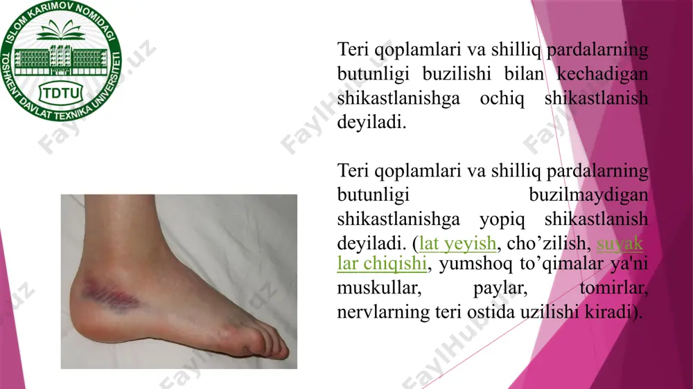 adillashtirishga qaratilgan kompleks davo tadbirlarini olib borishdan iborat xulosa. qorinnig yopiq shikastlanishlarida bemorlarda qorin bo'shlig'i gipertenziyasi sindromini rivojlanishini shubxa qilinganda o'z vaqtida qorin ichki bosimi darajasini monitoringni kuzatish kerak bo’ladi. qorin bo'shlig'ining qo'shma shikastlanishlarida qorin bo'shlig'i gipertenziyasi sindromini rivojlanishi o'lim ko'rsatkichlarini yuqoriligi bilan xarakterlanadi. qorin perfuzion bosim ko'rsatgichlarini oshishi organlar faoliyatini yetishmovchiligi va og'ir holatdagi bemorlarda ahvolini o'rtacha og'irlik darajasini statistik jihatdan korrelyatsiya qilishda muhim hisoblanadi. qorin bo'shlig'ini dekompressiya qilishga ko'rsatma qorin perfuzion bosim monitoringi asosida, organlar faoliyatini etishmovchiligining rivojlanishining klinik ko'rinishini hisobga olgan holda amalga oshiriladi. manbalar 1. m. m. aliyev. andominal xirurgiya, 2018, toshkent — 158-160 bet. 2. m. m. aliyev. bolalar xirurgiyasi, 2018, toshkent: yangi nashr — 158-160 bet e’tiboringiz uchun raxmat! image1.png image2.jpeg image3.jpeg image4.jpeg image5.jpeg image6.jpeg image7.png image10.jpeg image8.jpeg image9.jpeg image11.jpeg image12.jpeg image13.jpeg image14.jpeg image15.jpeg image16.jpeg image17.jpeg image18.jpeg image19.jpeg image20.jpeg image21.jpeg image22.jpeg image23.jpeg image24.jpeg image25.jpeg image26.jpeg image27.jpeg image28.png image29.jpeg