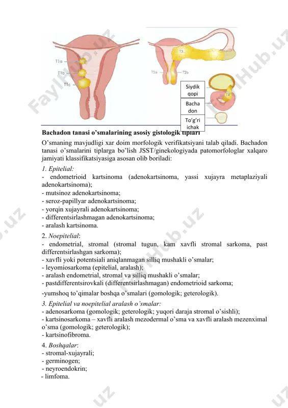 ma olish va oʼsmaning gistologik turi va differentsirovka darajasini koʼrsatuvchi gistologik xulosa asosida qoʼyiladi. figo–tnm klassifikatsiyasi bts ning tnm sistemasi va figo boʼyicha klassifikatsiyasi (uicc, 7-qayta koʼrik, 2009y) tnm figo ta'rif tx birlamchi oʼsma xolatini baholash imkoni yoʼq t0 birlamchi oʼsma yoʼq tis saraton in situ t1a ia oʼsma endometriy chegarasida yoki miometriy qalinligining yarimigacha oʼsib kirgan. t1b ib oʼsma miometriy qalinligining yarmidan koʼp qismiga oʼsib kirgan t2 ii oʼsma bachadon boʼyni stromasiga oʼsib oʼtgan, lekin bachadondan tashqariga tarqalmagan t3a iiia bachadon seroz qobigʼiga oʼsib oʼtgan, bachadon naylari va tuxumdonlar zararlanishi (oʼsmaning bevosita oʼsib oʼtishi yoki metastazlar) t3b iiib qin yoki parametriy zararlanishi (oʼsmaning bevosita oʼsib oʼtishi yoki metastazlar) t4 iva siydik pufagi yoki toʼgʼri ichak shilliq qavatiga oʼsib oʼtishi nx regionar limfa tugunlar xolatini baxolash imkoniyati yoʼq n0 regionar limfa tugunlarda metastazlar yoʼq (tos yoki bel l/t) n1 iiic regionar limfa tugunlarda metastazlar bor (tos yoki bel l/t) iiic1 …
