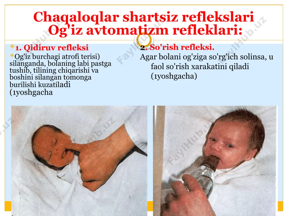 idan, dumg’azadan bo’yingacha barmoqlarni ozgina bosgan xolda yurg’izilsa. u tanasini bukib, boshini ko’taradi, oyog’i va qo’lini yig’ib qichqiradi va ba'zan siyib yuboradi (4 oygacha). 17. labirint tonus refleksi. bu refleks boshning xolatini fazoda uzgartirish bilan chakiriladi. chalkancha yotgan bolada buyin, orka, oyok yozuvchi mushaklari tonusi baland bulsa, qorni bilan yotganda yiguvchi mushaklar tonusi yuqori buladi. 18. buyinni simmetrik tonus refleksi. chalkancha yotgan chaqaloq boshini passiv egalganda, qo’lning eguvchi, oyoqning yozuvchi mushaklari tonusi oshadi. egilgan boshni ilgarigi xolatga keltirlganda esa teskari uzaro munosabat kuzatiladi. 19. assimmetrik bo’yin tonus refleksi. chalkancha yotgan bola boshini yelkaga tegadigan darajada yonga burilganda, shu tomon oyok- qo'l tonusi kamayib, qarama-qarshi tomonda oshadi (1 yoshgacha). 20. tanani tiklovchi reaktsiya. oyoq kaftini tayanch qismiga tegilib turg'izilgan bola boshini va tanasini tutishga xarakat qiladi (1 oylikdan keyin paydo bo’ladi). 21. landauning yuqori refleksi. qorni bilan yotqizilgan bola boshini va tanani yuqori qismini tekslikka qo'li bilan tayangan xolda ko'tarib turadi …