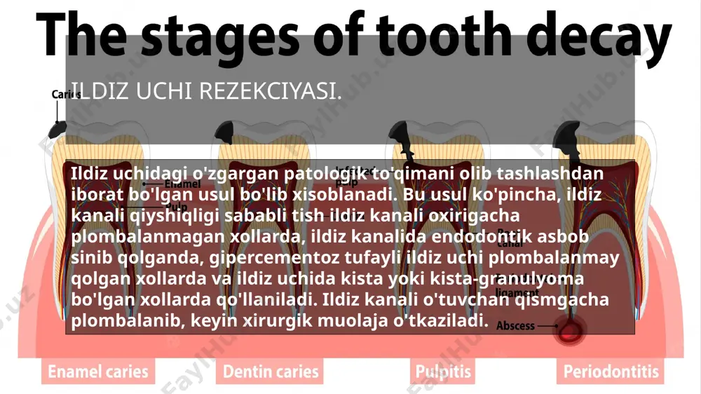 surunkali periodontitni konservativ-xirurgik davolash usullari - Page 3