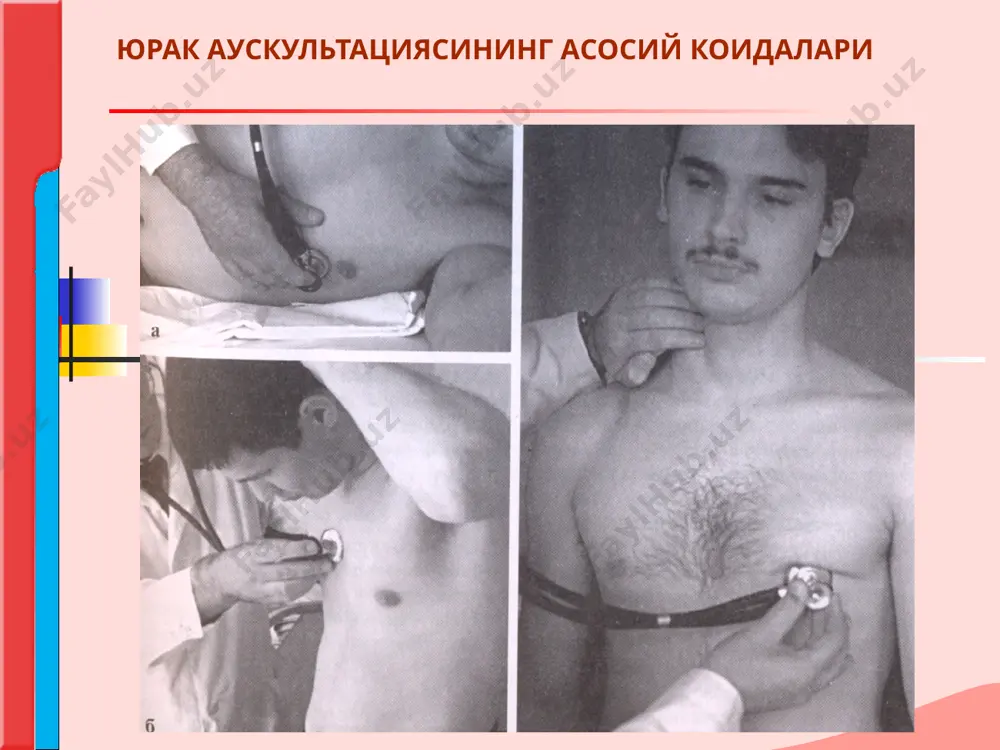 характеристикаси i тон юрак чуккисида яхши эшитилади. ii тон юрак асосида яхши эшитилади. i тон ii тондан - узок пауза (0,43 сек.) билан ажралиб туради. ii тон i тондан - кичик пауза (0,2 сек.) билан ажралиб туради. i тон узок давом этади,пастрок. ii тон кискарок ва баландрок. i тон юрак учи турткисига, уйку артерияси пульсациясига мос келади. юрак тонлари кушимча тонлар i-чи ii-чи тондан ташкари ёш болаларда, ёш, озгин одамларда баъзан iii ва iv тонлар эшитилади. iii тон бемор чап ёнбошида ётганда, юрак чуккисида ва боткин-эрб нуктасида яхши эшитилади. диастолада, ii тондан кейин 0,15-0,12 с дан сунг хосил булади. юрак тонлари iv тон пресистолада хосил булади.ююрак чуккиси ва боткин-эрб нуктасида i-тон билан биргаликда эшитидади. кари ёшдаги одамларда iii ва iv тонларни эшитилиши юрак мушакларини огир шикастланишини курсатади. юрак тонлари юрак тонлари юрак тонларина узгариши. тонлар узгариши: жаранглилиги, тембри, давомийлигини узгариши, иккига булиниши, кушимча тонларни хосил булиши билан намоён булади. юрак …