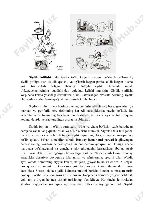 shuriya markazi va periferik nerv tizimining har xil kasalliklarida paydo bo’ladi. bu vegetativ nerv tizimining buzilishi munosabati bilan operatsiya va tug’uruqdan keyingi davrda uchrab turadigan asorat hisoblanadi. siydik tutilishi o’tkir, surunkali, to’liq va chala bo’lishi, azob beradigan darajada zahar tang qilishi bilan va busiz o’tishi mumkin. siydik chala tutilganda me'yorda toia va kuchli bo’lib turgan siydik oqimi ingichka, jildiragan, uzuq-yuluq bo’lib qoladi, ba'zan tomchilab turadi. bunday bemorlarni parvarish qilayotgan ham-shiraning vazifasi bemor qovug’ini bo’shatdimi-yo’qmi, uni kuniga necha marotaba bo’shatganini va qancha siydik ajratganini kuzatishdan iborat. asab tizimi kasalliklari bilan og’rigan bemorlarga alohida e'tibor berish lozim, bunday xastaliklar aksariyat qovuqning falajlanishi va sfinkterning spazmi bilan o’tadi, ayni vaqtda bemorning siygisi keladi, natijada, g’oyat to’lib va cho’zilib ketgan qovuq yorilishi mumkin. operatsiya yoki tug’uruqdan keyin, shuningdek, biron kasallikda 6 soat ichida siydik kelmasa imkoni boricha kateter solmasdan turib qovuqni bo’shatish choralarini ko’rish lozim. ko’pincha bemorni yolg’iz qoldirish yoki uni o’tirgan holatda ushlab …