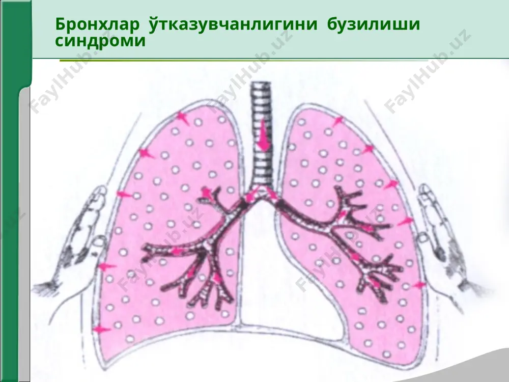нафас органлари касалликларида асосий клиник синдромлар. бронхлар ўтказувчанлигини бузилиши - Page 4