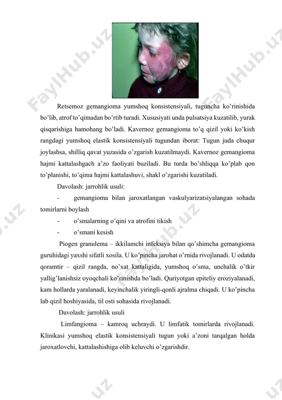 davolash: nur bilan, jarrohlik usuli, kriodestruksiya. natijasi: yaxshi deb baholash mumkin. til raki ko’pincha uning yon tomoni o’rta qismida kuzatiladi, kam hollarda til ildizida. lunj raki lunjning turli qismida uchraydi. lunj raki tezda retromolyar sohaga tarqaladi, chaynov va qanot-tanglay muskullari yuzasida kontraktura keltirib chiqaradi. regionar tugunlar tildagi rakka nisbatan kamroq shishadi. bir qator yuz-jag’ sohasidagi rak bilan og’rigan bemorlarning anamnezida og’izda surunkali shikastlanishlar borligini aniqlash mumkin: karioz kavakli tishlar, noto’g’ri qo’yilgan plombalar, yomon tayyorlangan protezlar sabab bo’ladi. turli xil yomon odatlar (chekish, nos) kasbiy omillar. davoning natijasi o’sma to’qimasining gistologik tuzilishiga, joylashishiga, o’sish shakliga, regionar sohalarga metastaz bergan – bermaganiga bog’liq. ko’pchilik bemorlar agar jarohatlanishi chegarali bo’lsa, mehnat qilish qobiliyatini yo’qotmaydi. bunga albatta nutq bilan bog’liq bo’lgan sohalar ishchilari kirmaydi. jismoniy jihatdan ishi og’ir bo’lgan bemorlarni yengilroq mehnatga o’tkazish zarur. agar rak o’smalari tarqalgan jarayon bilan kechsa, davolash-tiklash operatsiyasidan so’ng nogironlikka chiqariladi. bunday bemor o’zlarini najotsiz sezganliklari uchun ularga iloji …