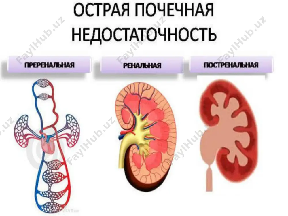 buyrak etishmovchiligida siydik yo'llarining torayishi sababini aniqlash uchun kt, mri va ultratovush ko'pincha qo'llaniladi. xromotsistoskopiya oddiy, tez va xavfsiz diagnostika usuli bo'lib, tez-tez favqulodda vaziyatlarda qo'llaniladi. buyrak biopsiyasi. tashxis qo'yishning iloji bo'lmaganda, shubhali holatlarda biopsiya qo'llaniladi. ekg. ushbu tadqiqot o'tkir buyrak etishmovchiligi bo'lgan barcha bemorlar uchun majburiydir. bu yurak muammolari va aritmiyalarni aniqlashga yordam beradi. etishmovchiligida o'tkir buyrak etishmovchiligi bemorni nefrologiya shifoxonasida darhol kasalxonaga yotqizishni talab qiladi. bemorning ahvoli og'ir bo'lsa, u intensiv terapiya bo'limiga joylashtiriladi. terapiya buyrak disfunktsiyasining sabablariga bog'liq. malakali shifokorni tashish yoki kutish vaqtida bemorga to'liq dam olish, iliq adyol bilan o'ralgan va gorizontal holatga keltirilishi kerak. etiologik omillarni bartaraf etish uchun quyidagi dorilar qo'llaniladi: yuqumli kasalliklar uchun antibiotiklar; qon oqimini oshirish va periferik shishning oldini olish yoki yo'q qilish uchun diuretiklar; miyokard disfunktsiyasi uchun yurak dori-darmonlari; elektrolitlar muvozanatini tiklash uchun tuz eritmalari; qon bosimini pasaytirish uchun antihipertansif dorilar. ildiz sababini bartaraf etgandan so'ng, konservativ dori terapiyasi …