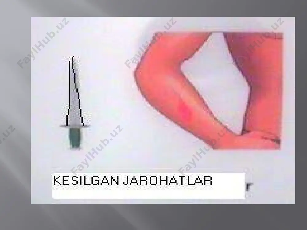 jarohatlanishlar modellari va unit tahlil qilish - Page 4