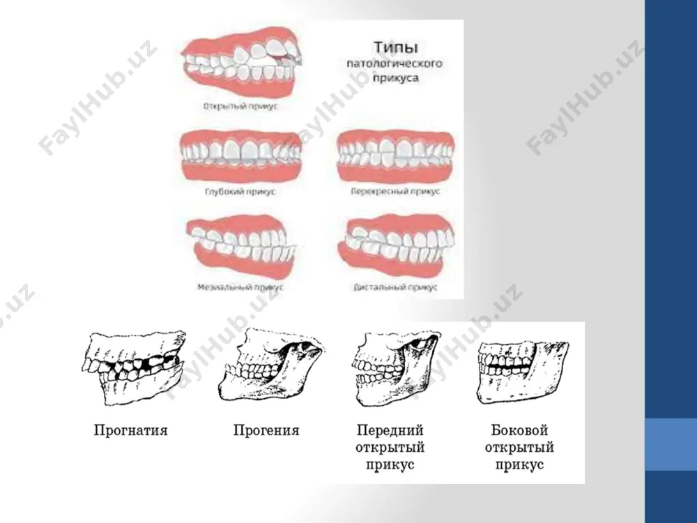 dislaliya. uning kelib chiqish sabablari. sigmatizm va uning turlari - Page 5