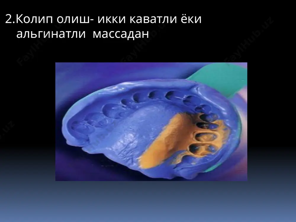 пластмассали коплама - Page 4