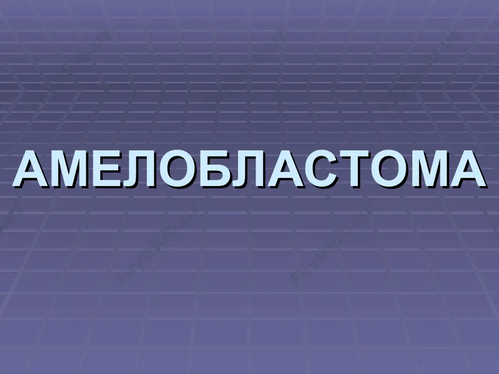 сти в области 8-го зуба. рентгенограмма. тот-же снимок увеличенный. одонтома верхней челюсти. рентгенограмма. тот-же снимок увеличенный. одонтома нижней челюсти. рентгенограмма. внешний вид простой неполной корневой одонтомы. рентгенограмма простой неполной корневой одонтомы. сложная одонтома. (рентгенограмма). внешний вид частей сложной одонтомы. одонтома нижней челюсти. (рентгенограмма). цементома цементома в области 8-го зуба нижней челюсти. рентгенограмма нижней челюсти больного с истинной цементомой. рентгенограмма нижней челюсти больного с периапикальной цементной дисплазией. гигантская цементома. одонтогенная фиброма одонтогенная фиброма нижней челюсти слева. остеобласток-ластома типичная картина собственно опухолевой ткани остеобластокластомы. гигантская многоядерная клетка. признаки неоостеогенеза и хрящеобразования в опухолевой ткани. остеобластокластома тела нижней челюсти слева. (до операции.) остеобластокластома тела нижней челюсти слева. (через 1 мес. после операции.) остеобластокластома тела нижней челюсти слева. (через 5 мес. после операции.) внешний вид больного с остеобластокластомой верхней челюсти. внешний вид больного с остеобластокластомой верхней челюсти. внешний вид больного с остеобластокластомой верхней челюсти. хондрома хондрома. хондроциты с нежно-голубой цитоплазмой, с оксифильной зернистостью на …