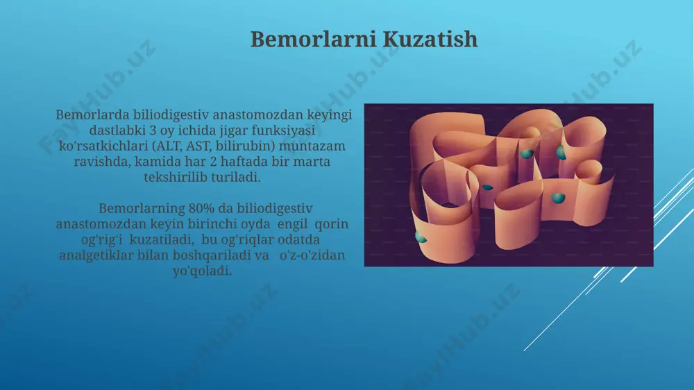 biliodigestiv anastomozlar - Page 4