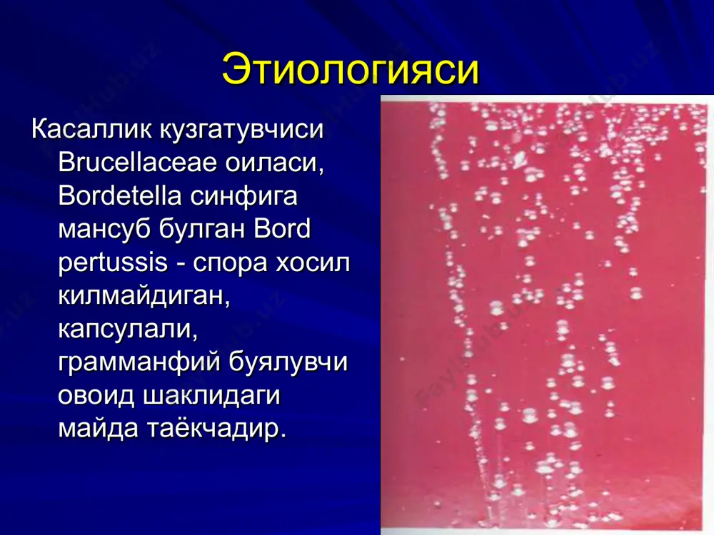шарт эмас. этиотроп даво. патогенетик даво. десенсибилловчилар. организмни курашиш кобилиятини ошириш. профилактикаси 1. вацинация- акдс. 2. бемор изоляция килинади, 40 кунга. 3. бемор билан мулокатда булган 10 ёшгача болалар 14 кун изоляция килинадилар. 4. иммуноглобулин.