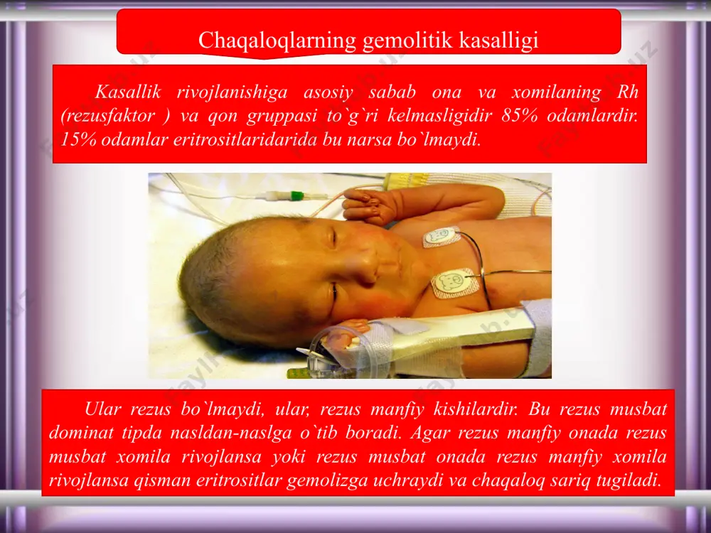 chaqaloqlar kasalliklari va ularni parvarish qilish - Page 5