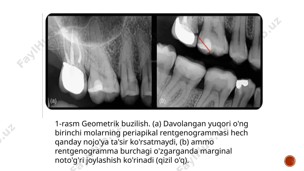 ntgen tasvirini olish imkonini beruvchi qurilma. ichkarida vatech radioviziografi o‘ta sezgir sensor bilan jihozlangan bo‘lib, uning yordamida qurilma raqamli shakldagi tasvirni oladi va kompyuterga uzatadi hech qachon kasal bo’lmang!!! image4.png image3.png image5.jpeg image6.jpeg image7.jpeg image8.jpeg image9.jpeg image10.jpeg image11.jpeg image12.jpeg image13.jpeg image14.jpeg image15.jpeg image16.jpeg image2.png /docprops/thumbnail.jpeg