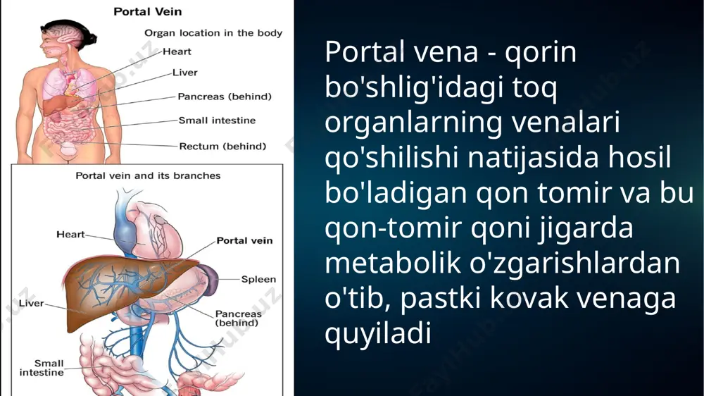 tishlar yuz neradi klinikasi taloq venasi dimlanishi: - trombositopeniya - leykopeniya - anemiya splenomegaliya gemoradial vena dimlanishi: - najasda qon bo'lishi - og'riqli ich kelishi gemoroy jigardan won ketishini qiyinlashuvi va limfa o tkazuvchanligini buzilishi - gipoalbunemiya - giperaldesteronizm - elektrolit buzilishi assit qizilo'ngach va me'da varikozi va qon ketishi gastro-ezofagial soxa qon-tomirlarining ekstaziyasi (kengayishi) bilan namoyon bo'ladi. qattiq ovqat iste'molida, og'ir jismoniy mehnat paytida, qattiq yo'talganda shilliq osti qavat varikozlaridan qon ketadi shikoyatlari: qorin kattalashishi qon ketishlar (qora axlat va qusish) umumiy xolsizlik, charchash •uyquchanlik, bosh og'rig'i •metiorizm, kekirish •ozib ketish •quruq teri •badani yer rangida yoki ko'kimtir-sarg'ish •tomir yulduzlari (meduza boshchalari) •assit •ozg'in •ensafalopatiyalar (gepato-portal dismatetabolik buzilishlar hisobiga) tashqi ko'rinishi child-pugh bo'yicha jigar serrozi klassifakatsiyasi a kompensatsiya - 5- 7 ball b subkompensatsiya - 8-10 ball c dekompemsatsiya - 10 balldan katta diagnostika utt, mrt, kt endovaskular pvga teri orqali kirish pastki kovak vena orqali kirish 3. arteriya …