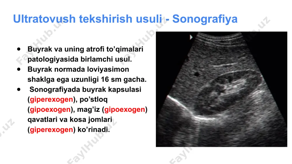 'q bo'lsa) noto'liq ikkilanishni ut-da aniqlash qiyin, chunki normal funksiya bajarayotgan siydik nayini ut orqali ko'ra olmayrniz. rasmda: orgadan olingan buyrak exogrammasi. ikkiga bo'lingan markaziy exokompleks, bertini ustunchasi. bo'ylama olingan exogramma. yuqorigi buyrak kosacha-jomcha tizimi kengaygan, pastki buyrakniki esa minimal kengaygan. ko'ndalang olingan qovuq exogrammasi. ureterosele. ageneziya buyrak rivojlanmay qoladi buyrak usti bezi yaxshiroq ko’rinadi buyrak joylashgan soha bo’sh qoladi taqasimon buyrak buyrakni taqa shaklida bo’lishi asosan pastki qutibi orqali bir-biriga qo’shikib qolishi epigastral sogadan pastroqda datchikni qoyganda yaxshi ko’rinadi siydik qopi utt norma. polipsimon o’sma. buyrak kistalari polikistoz. og’rik, gematuriya, buyrak yetishmovchiligi va gipertenziya sababi bo’lishi mumkin. autosom dominant kasallik, 30 yoshdan keyin uchraydi. ko’pincha ikkala buyrak shikastlanadi. birdaniga kistalar boshqa parenximatoz a’zolarda uchrashi mumkin, bosh miyada esa 10% bemorlarda anevrizmalar. 20% xolatda siydik nayida tosh xosil bo’ladi. kistalar oxaklanishi mumkin. ultrasonografiyada bu kasallik yaxshi aniqlanadi, buyrak kattalashgan, strukturasida ko’p sonli gipoexogen gomogen, chetlari aniq tekis tuzilmalar. ultratovush kuchayish …