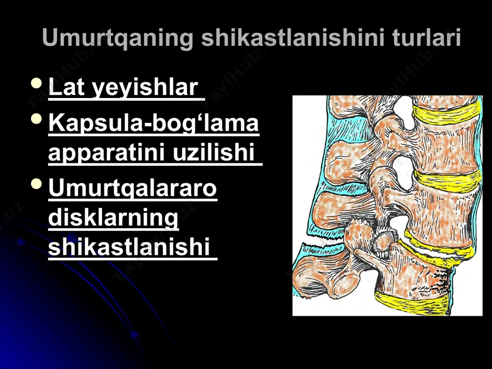 i giperesteziya turda buzilishi umurtqa va orqa miyaning shikastlanishlari diagnostikasi bemorlarga umurtqa obzor spondilografiya, kompyuter va magnit-rezonans tomografiya tekshiruvlari o‘tkaziladi likvor tahlili umurtqa va orqa miyaning yopiq shikastlanishlarida lyumbal punksiya o‘tkazilishi shart. likvor bosimi suv manometri bilan o‘lchanadi. subaraxnoidal bo‘shliq o‘tkazuvchanligini aniqlash uchun likvorodinamik sinamalar o‘tkaziladi: 1. kvekkenshtedt sinamasi (vrach yordamchisi bo‘yinturuq venalarini bosib turadi). normada likvorning bosimi 400-500 mm. suv. ust. teng bo‘lishi mumkin 2. stukkey sinamasi ( vrach yordamchisi pastki kovak venani qorin sohasida musht bilan bosadi). normal xolatda likvor bosimi to 300-400 mm .suv. ust.gacha bo‘lishi mumkin. . yuqorida ko‘rsatilgan sinamalarda likvor bosimning o‘zgarmasligi subaraxnoidal bo‘shliqning to‘liq to‘silganidan darak beradi. subaraxnoidal bo‘shliqning to‘liq to‘silganligi orqa miyaning bosilayotganligi va dekompressiv operatsiya o‘tkazish lozimligini ko‘rsatadi subaraxnoidal bo‘shliqning qisman to‘silganligini likvor bosimining kam va sekin(10 sekunddan ziyod) ko‘tarilishidan anglash mumkin. likvorodinamik sinamalar tugatilgandan so‘ng likvor bosimi asl xolatiga qaytmaydi. likvorodinamik sinamalarning grafiklardagi tasviri umurtqa va orqa miya shikastlanishlari bo‘lgan bemorlarni …