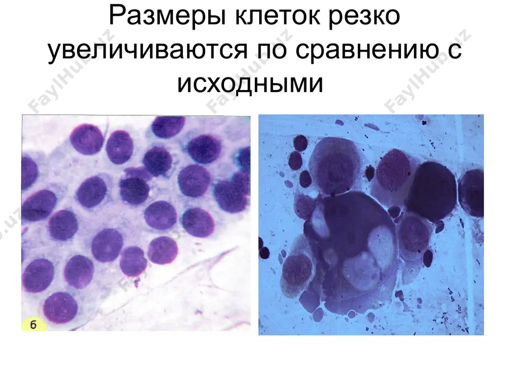 определение злокачественности клеточных элементов - Page 2