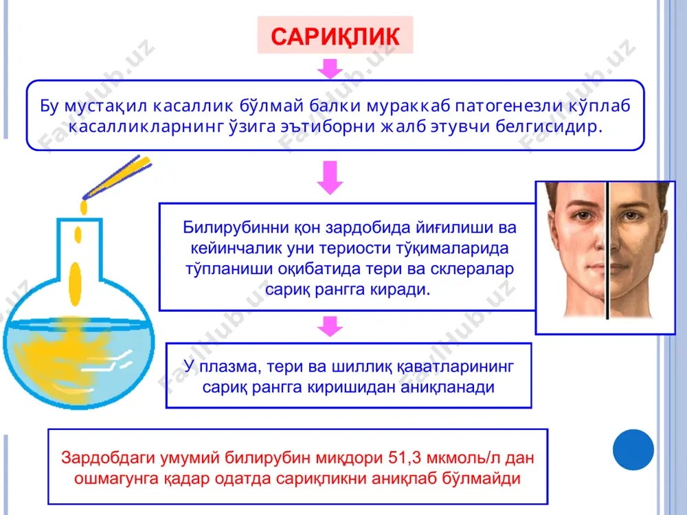 норея, гиперкортицизм белгилари, телеангиоэктазиялар, палмар эритема, гипатоспленомегалия мавжуд. жигар циррози 20-30% ҳолларда циррозларнинг этиологияси номаълум (криптоген) заҳарлар, дориларнинг токсик таъсири қон айланишининг сурункали етишмовчилиги (димланган жигар) сурункали алкоголли заҳарланиш жигар циррози ривожланишининг асосий сабаблари ўт йўлларининг сурункали касалликлари уларни ўтказувчанлигини бузилиши билан бирга метаболик бузилишлар (гемахроматоз, вильсон-коновалов касаллиги,  1-антитрипсин етишмовчилиги, овқатланишдаги бузилишлар ва ҳ.к.) веноз оқимнинг бузилиши (бадд-киари синдроми) ўтказилган вирусли гепатитлар (в ва с) жигар циррози сурункали гепатитларда кузатиладиган белгилар портал гипертензия сабаб бўлган белгилар: спленомегалия (эрта белги), қизилўнгач, геморроидал томирларнинг варикоз кенгайиши асцит паренхиматоз ва томир декомпенсацияси сабабли пайдо бўлган белгилар сурункали жигаричи холестаз кўринишлари устувор, унга ҳақиқий жигар циррози белгилари қўшилади жигар етишмовчилиги зўрайиб боради, суякларнинг, айниқса умуртқа поғонасининг диффуз остеопорози билан бирга портал гипертензия синдроми бўлаклараро ўт оқимларини зарарловчи хос иммун комплекслар шаклланиши билан боғлиқ жигарнинг бирламчи билиар циррози тери қичишиши, тўқ сариқлик, ксантелазмлар, ксантомалар, гепатомегалия, стеаторея, эчтнинг “сабабсиз” ошиши жигар қаттиқ консистенцияли, пайпасланганда сезгисиз …