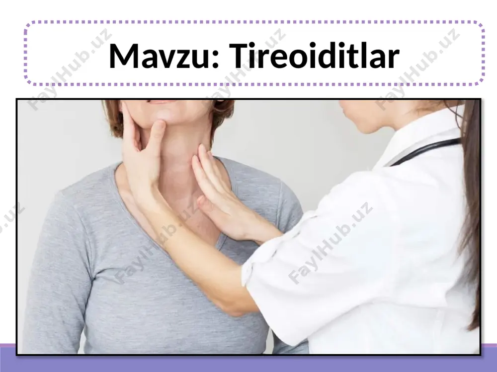 i o’tkir yoki surunkali yuqumli kasalliklar – tonzillit, pnevmoniya, sepsis va boshqalardan so’ng, ularning patogenlarini qalqonsimon bez to’qimalariga gematogen tarzda kirishi natijasida yuzaga keladi. tireoiditning o’tkir yiringli bo’lmagan shakli qalqonsimon bezning shikastlanishi, radiatsiyaviy shikastlanishi natijasida, shuningdek, uning to’qimalarida qon ketishidan keyin rivojlanishi mumkin. o’tkir osti (granulomatoz) kerven tireoiditi turli infektsiyalarning patogenlari: adenoviruslar, qizamiq viruslari, gripp, parotit tomonidan qalqonsimon bez hujayralariga virusli zarar yetkazishga asoslangan. kasallik 5-6 baravar tez-tez rivojlanadi, asosan 20 yoshdan 50 yoshgacha bo’lgan ayollarda, virusli infektsiya natijasidan bir necha hafta yoki oy o’tgach klinik namoyon bo’ladi. kerven tiroiditi epidemiyasi eng katta virusli faollik davrlari bilan bog’liq. o’tkir osti tiroidit autoimmunga qaraganda 10 baravar kamroq rivojlanadi va qalqonsimon bezning qaytariladigan, vaqtinchalik disfunktsiyasi bilan birga keladi. nazofarenksning surunkali infektsiyalari va irsiy omillar o’tkir osti tiroiditning rivojlanishiga sabab bo’ladi. fibroz tireoidit (ridel buqog’i) bilan qalqonsimon bezdagi biriktiruvchi to’qimalarning sezilarli darajada ko’payishi va bo’yin tuzilmalarining siqilishi mavjud. ridel buqog’ining rivojlanishi 40-50 yoshdan …