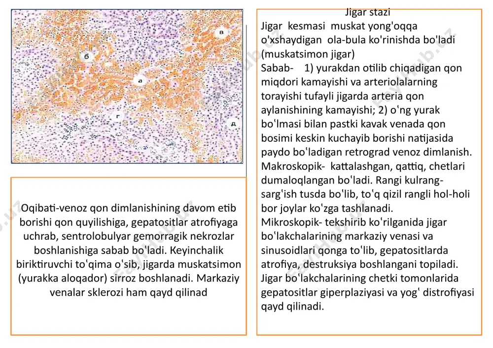 klеrozi ham qayd qilinad 4 yurakning qongir atrafiysi sabab- 1) nеyrotik, 2) dis­funksional atrofiya, 3) qon bilan ta’minlanish yyеtishmovchiligiga aloqador atrofiya, 4) fizik va kimyoviy omillar ta’siridan bo‛ladigan atrofiya, 5) mехanik omillar (bosim) dan bo‛ladigan atrofiya og`ir uzoq davom etuvchi yuqumli kasalliklar, xavfli o`smalar - mexanizmi- hujayralarining sitoplazmasida qo‛ng‛ir rangi bilan ajralib turadigan lipofussin pigmеnti bo‛lakchalari paydo bo‛ladi. bu pigmеnt tabiatan yog‛-­oqsilli bo‛lib, hujayra eskirgan mahallarda yuzaga kе­ladi. lipofutsin gеpatositlar, nеyronlar va kardiomio­sitlarda hammadan ko‛ra ko‛proq topiladi. hujayralarda ko‛p miqdor lipofussin paydo bo‛lishi natijasida o‛sha or­ganlar qo‛ng‛ir tusga kirib qoladi. . makroskopik-atrofiyaga uchragan yurakda yurak qorinchalari­ning dеvorlari yupqa tortib, yurak bo‛shliqlari kеngayib kе­tadi.toj arteriyalari to`laqonli tusda oqibati –yurak yetishmovchiligi, yurak mushak tolalari yupqalashadi, miokard lipofussinozi rivojlanishi opka venoz tolaqonlilik упкада kон узоk димланиб kолиши жиддий оqибатларта олиб келади, бу юрак касалликларида курилади. юрак ишининг бузилиши упкада веноз qон билан бир qаторда артериал qoн тупланиб qолишига олиб боради. юрак порогида (асосан …