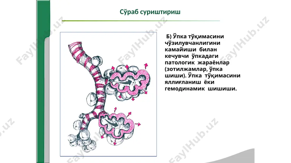1.ekspirator tipdagi xansirash 2.samarasiz yo'tal 3.diffuz kulrang tsianoz 4.bo'yin venalarini bo'rtishi 5.yuz chakkalarida patologik qizillik ko'zdan kechirish ko'zdan kechirish 5.nafas organlarini ko'zdan kechirish: -nafasni burundan olish -gerpetik toshmalar -ovozni bo'g'ilishi 6.ko'krak qafasini ko'zdan kechirish: a)formasi- fiziologik: normostenik, astenik, giperstenik. ko'zdan kechirish ko'zdan kechirish ko'zdan kechirish ko'zdan kechirish chuqur nafas olganda ko'krak qafasini simmetrikligi ko'krak qafasini tinch holatda nafas olganda simmetrikligi qovurg'alararo sohalarni o'zgarishi sindromlar yoki kasalliklar ko'krak qafasini bir tomoni nafas olishda ishtirok etmaydi ko'krak qafasi simmetrik o'zgarishlar yo'q. qovurg'alar orasi kengaygan ko'krak qafasi “bochkasimon” 1.norma 2.bronxoobtstruktiv sindrom. 3.o'pka emfizemasi ko'krak qafasini shikastlangan tomoni kattalashgan qovurg'alar orasi silliqlashgan yoki bo'rtib chiqqan (litten simptom) ko'krak qafasini shikastlangan tomoni kattalashgan ko'krak qafasini shikastlangan tomoni kichraygan 1.gidrotoraks 2.pnevmotoraks qovurg'alar orasi silliqlashgan yoki bo'rtib chiqqan (litten simptom) qovurg'alar orasi kichraygan 1.o'pka bo'lagi zichlashgan 2.o'pka to'qimasini massiv zichlashishi 3.o'pkada katta bo'shliq 1.gidrotoraks 2.pnevmotoraks 1.obturatsion atelektaz 2.fibrotoraks 3.o'pka to'qimasini puchayishi (o'pka tserrozi) ko'krak qafasini ko'zdan kechirish …
