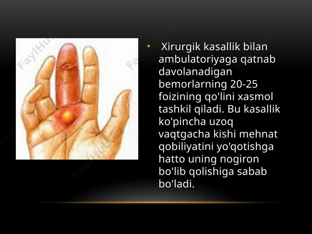 ak paylari va bosh barmoqning uzoq bukuv paylari bilan chegaralangan. davosi . dastlabki bosqichda issiq vannachalar, spirtli kompresslar qo'llaniladi. jgut bilan bog'langan venaga antibiotiklar yuboriladi. klinik manzarasi. payda qattiq og'riq paydo bo'ladi. barmoqlarning shishgani ma'lum bo'ladi, bemor ularni yarim bukib oladi. barmoqni to'g'rilashga harakat qilinsa og'riqning birdaniga kuchayib ketishi kuzatiladi, bu esa uning xarakterli siptomidir. barmoqlarning yiringli tendovaginiti umumiy buzilishlar - bosh og'rishi, darmonsizlik, yuqori harorat bilan birga kechadi. ayniqsa, i va v barmoqlarning yiringli tendovaginitlari xavflidir. davosi . kasallikning dastlabki soatlaridayoq pay qinini punksiya qilib, ekssudatni chiqarib yuborish va o'z navbatida antiiotiklarni yuborish tavsiya etiladi. pay qiniga 1-2 ml suyuqlikdan ortiq sig'maydi, shuning uchun antibiotiklar yuqori konsentratsiyada yuboriladi. jgutdan foydalanib antibiotiklarni venaga yuborish afzal va bunda qo'l immobilizatsiya qilinadi. agar konservativ davo foyda bermasa, jarrohlik yo'li bilan davolash tavsiya etiladi. yallig'lanish o'chog'ini yorish asosiy falanganing oldingi yon yuzasi bo'ylab parallel kesmalar qilish, ayni paytda, noaniq(yopiq) qinni ochish uchun kaftda …