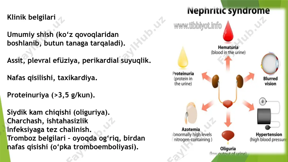 nefrotik kriz shoshilinch yordam - Page 5