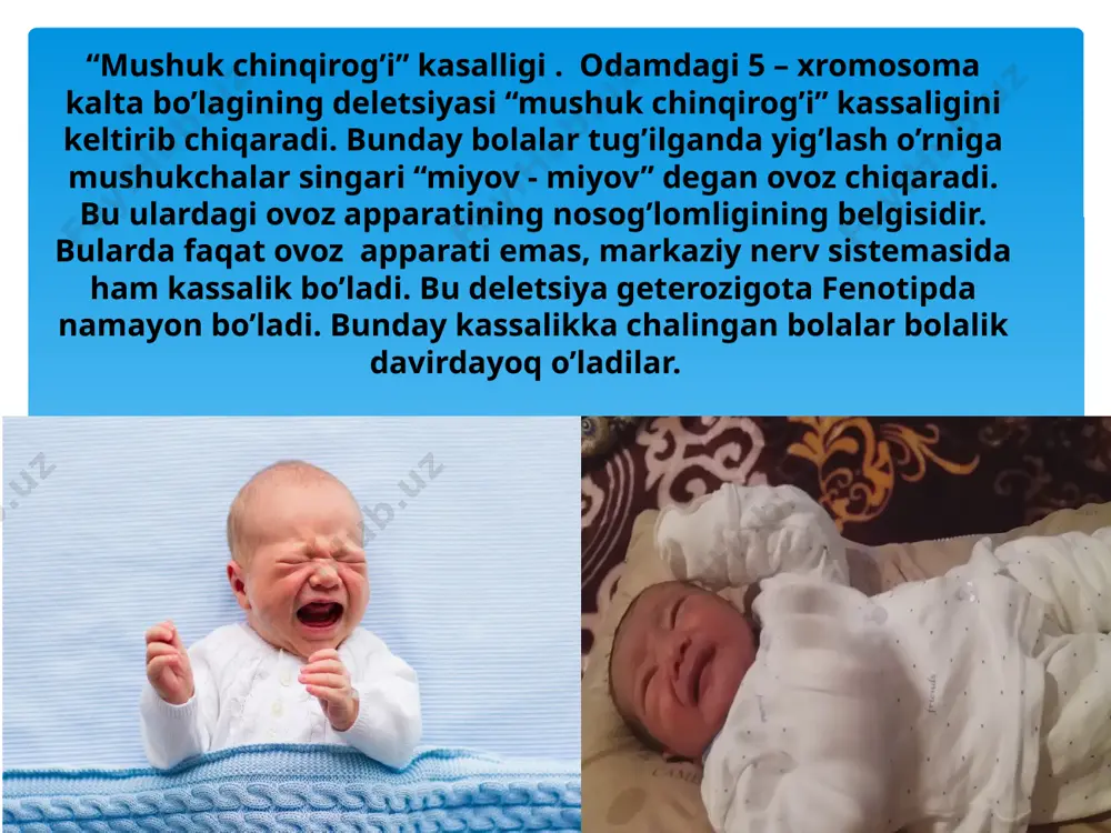 jinslar orasida uchrash nisbati 1:2 – erkak:ayol. nisbatan kam uchraydi, 1 : 50 000. 30 yoshgacha yashaydi. vilyams sindromi — 7-juft xromosomadan 27 ta genning deletsiyasi hisobiga yuzaga keladi. ushbu sindromda barcha bolalar aqliy zaiflik bilan tug’iladi. iq darajasi 50 dan past bo’ladi. 20 000 tadan bitta bola shu sindrom bilan tug’iladi. jakobsen sindromi — 11-juft xromosomadagi ayrim genlar deletsiyasidan kelib chiqadi. bunda ushbu xromosomadan 5 – 16 mln dnk nukleotidlari deletsiya bo’lgan bo’ladi. bolalarning aksariyati 2 yoshgacha vafot etadi. 100 000 ta boladan bittasi mana shu xastalik bilan og’riydi deb hisoblanadi. smit-magenis sindromi — 17-juft xromosoma kichik yelkasidagi ayrim genlarnign deletsiyasidan kelib chiqadi. aqliy zaiflikka sabab bo’ladi. 1 : 15 000 va 1: 25 000 nisbatda uchraydi. di jorj sindromi — 22-juft xromosomadagi 30 – 40 ga yaqin genlarning deletsiyasidan kelib chiqadi. har 4 000 ta boladan bittasi mana shu sindrom bilan og’riydi. e’tiboringiz uchun raxmat image2.jpeg image3.png image4.png …